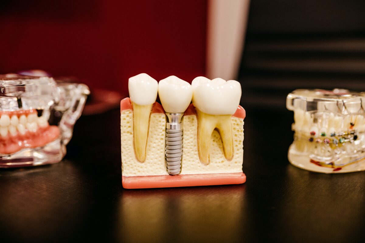 3d-printing-dental-applications